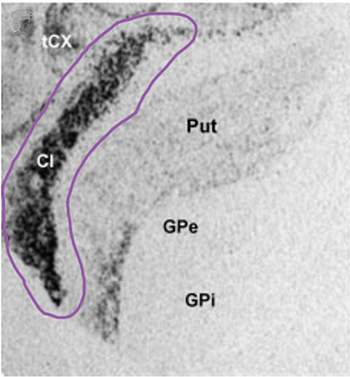 Figure 2: Kappa-opioid receptors are highly expressed in the claustrum. 